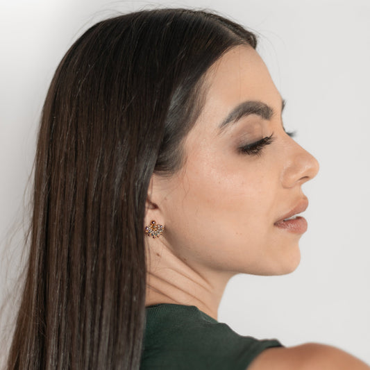 Arete Bianca